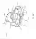 Fig. 13 - Microblister skin grafting