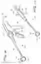 Fig. 09 - Vacuum assisted surgical dissection tools