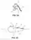 Fig. 04 - Tissue manipulation tool