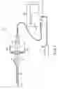 Fig. 03 - Method for replacement arthroplasty