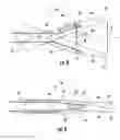 Fig. 04 - VIBRATING SURGICAL INSTRUMENTS FOR BLUNT DISSECTION AND METHODS FOR USE THEREOF