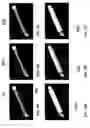Fig. 05 - Needle with piezoelectric polymer sensors