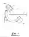 Fig. 02 - Surgical guidance devices, methods, and systems