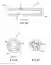 Fig. 07 - Medical device for removing an implanted object