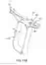 Fig. 19 - Medical device for removing an implanted object