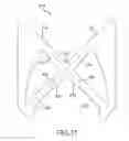 Fig. 52 - Medical device for removing an implanted object
