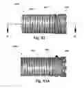 Fig. 55 - Medical device for removing an implanted object