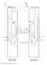 Fig. 62 - Medical device for removing an implanted object