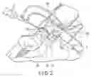 Fig. 03 - METHOD FOR ANKLE ARTHRODESIS