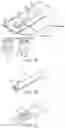 Fig. 04 - METHOD FOR ANKLE ARTHRODESIS