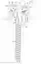 Fig. 01 - Double-headed pedicle screw