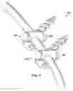 Fig. 06 - Posterior stabilization systems and methods