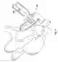 Fig. 09 - Posterior stabilization systems and methods