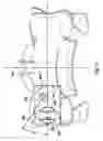 Fig. 10 - Posterior stabilization systems and methods
