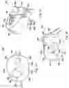 Fig. 29 - Posterior stabilization systems and methods