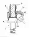 Fig. 01 - Vertebral osteosynthesis equipment