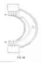 Fig. 09 - Dynamized interspinal implant