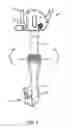 Fig. 06 - Surgical instrument and method