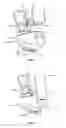Fig. 07 - Surgical instrument and method