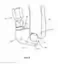 Fig. 08 - Surgical instrument and method