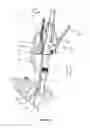 Fig. 09 - Surgical instrument and method
