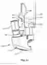 Fig. 15 - Surgical instrument and method