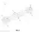 Fig. 03 - PLATES FOR GENERATING, APPLYING AND MAINTAINING COMPRESSION WITHIN A BODY