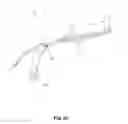 Fig. 23 - PLATES FOR GENERATING, APPLYING AND MAINTAINING COMPRESSION WITHIN A BODY