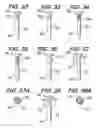 Fig. 07 - Orthopedic Fixation Screw With Bioresorbable Layer