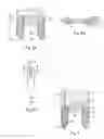 Fig. 07 - Method and implant for stabilizing two bone portions separated by a cut or fracture