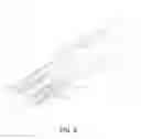 Fig. 07 - Arthroscopic devices and methods