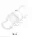 Fig. 09 - Arthroscopic devices and methods