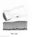 Fig. 13 - Arthroscopic devices and methods