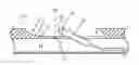 Fig. 01 - Side-port catheter