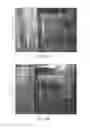 Fig. 12 - Physician controlled tissue resection integrated with treatment mapping of target organ images