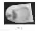 Fig. 57 - Physician controlled tissue resection integrated with treatment mapping of target organ images