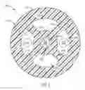 Fig. 06 - Surgical instrument shaft