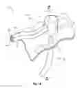 Fig. 09 - MAGNETICALLY COUPLING DEVICES FOR MAPPING AND/OR ABLATING
