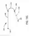 Fig. 17 - Surgical robotic system and method for controlling an instrument feed rate