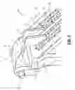 Fig. 04 - Tissue stop for surgical instrument