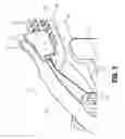 Fig. 05 - Tissue stop for surgical instrument