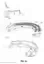 Fig. 10 - Tissue stop for surgical instrument