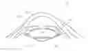 Fig. 01 - Membrane for protecting intraocular tissues and the protection methods used thereof