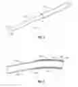 Fig. 03 - SYSTEM AND METHOD FOR DETECTING BENDING OF AN ELECTROSURGICAL DEVICE