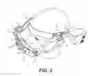 Fig. 04 - Method for performing stereotactic brain surgery using 3D geometric modeling