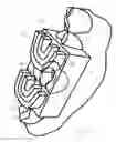 Fig. 07 - Dental tool and guidance devices
