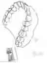 Fig. 17 - Dental tool and guidance devices