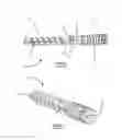 Fig. 02 - DENTAL POST DESIGNED FOR IMPROVED CROWN BONDING AND REDUCED ROOT DAMAGE