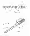 Fig. 05 - DENTAL POST DESIGNED FOR IMPROVED CROWN BONDING AND REDUCED ROOT DAMAGE