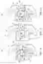 Fig. 05 - Orthodontic bracket